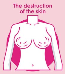Skin Destruction